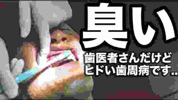 【歯周病に効く】口臭が気になる人へ魔法の歯磨き粉？歯周病のベテラン歯科医が実践！