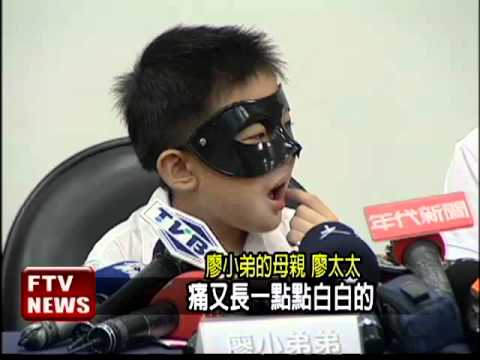 亞洲最小口腔癌 患者僅7歲!－民視新聞